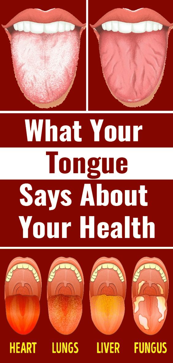 What Your Tongue Says About Your Health - wellness topic