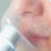 Το σοβαρό άσθμα επιβαρύνει σημαντικά τη ζωή των ασθενών παγκοσμίως