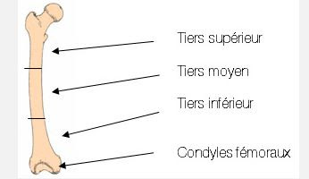 Un médecin du sport vous informe: fractures diaphysaires et de l ...