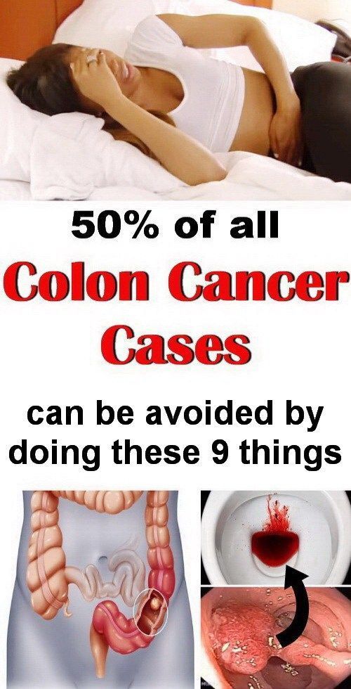 first signs of colon cancer