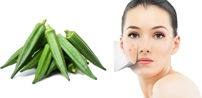 Face Pack for Pimple/Acne-Prone Skin