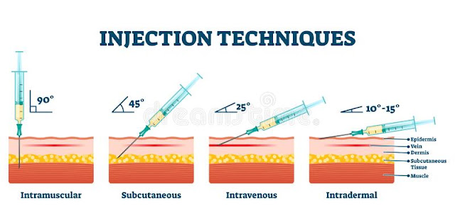 TYPES OF INJECTION