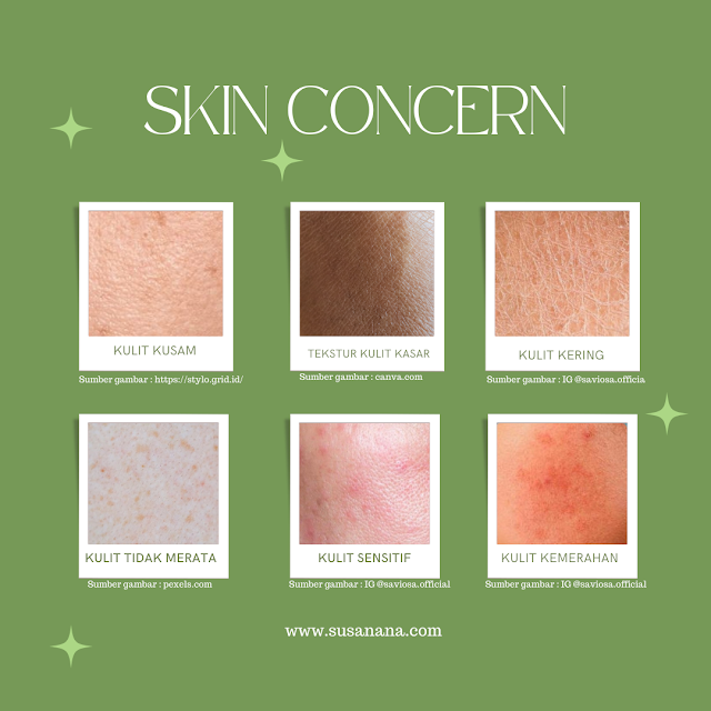 Masalah kulit kamu