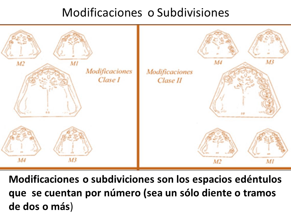 rehabilitaci-n-ii-clasificaci-n-kennedy-1-parte-unidad-ii-y-video