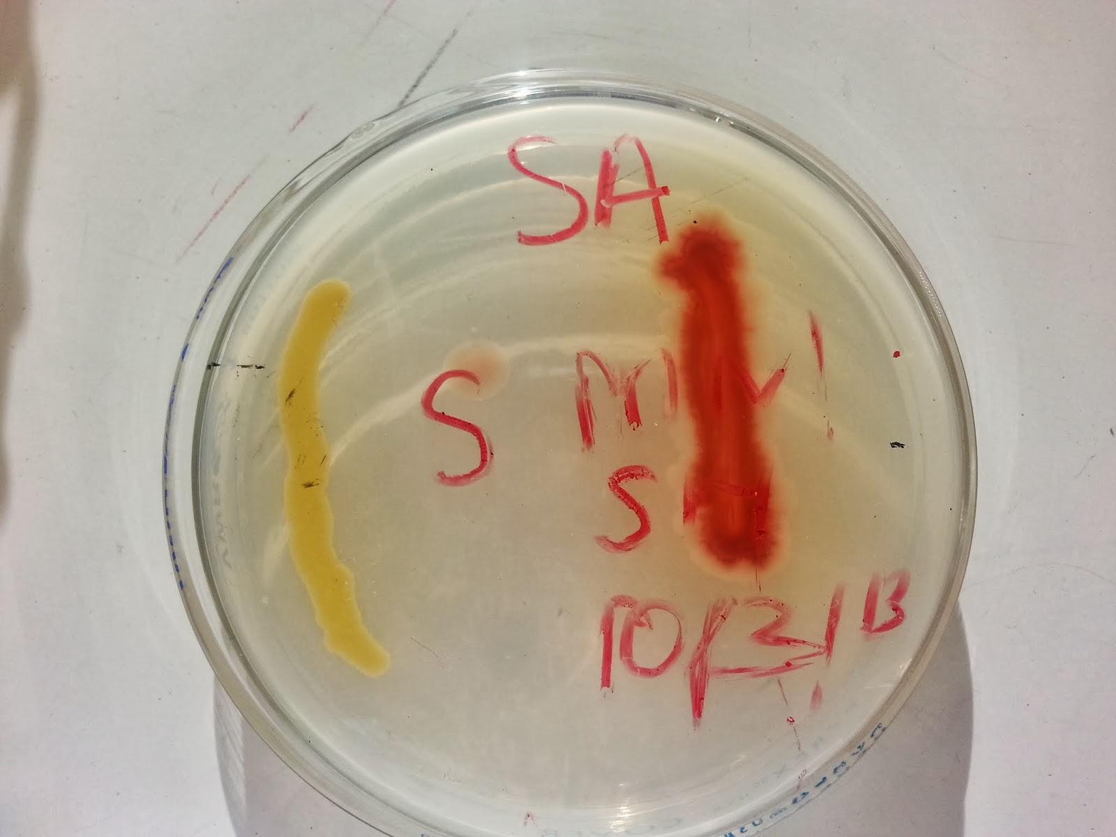 gelatin hydrolysis test e coli gelatin hydrolysis test e coli