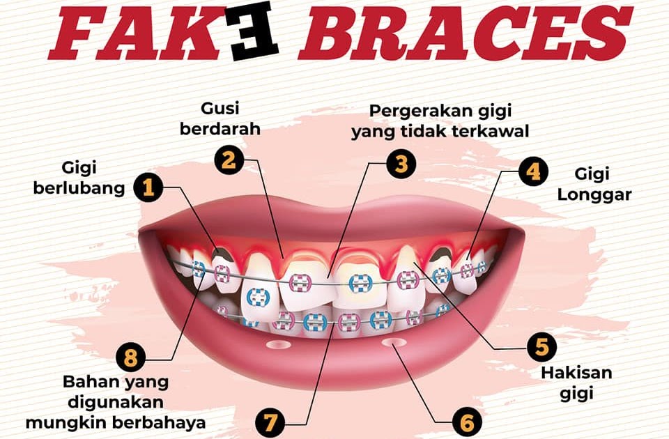 National Cancer Society of Malaysia, Penang Branch Bahaya Fake Braces