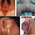 Obat sipilis di apotik surabaya thumbnail
