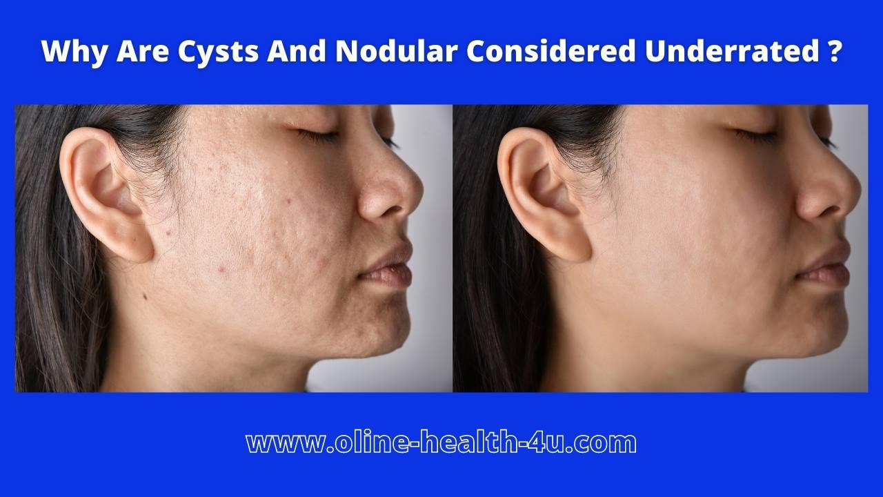 Cysts and Nodular