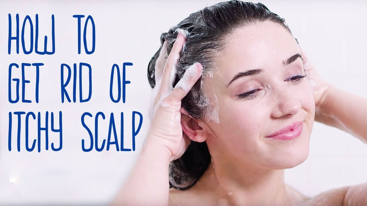 how to get rid of itchy scalp