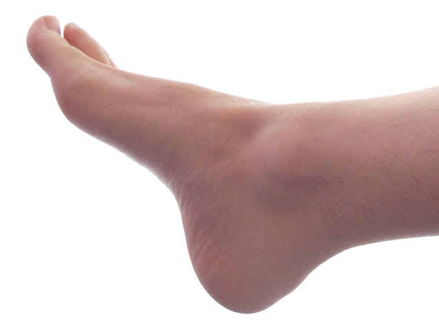 Male Right Foot 1