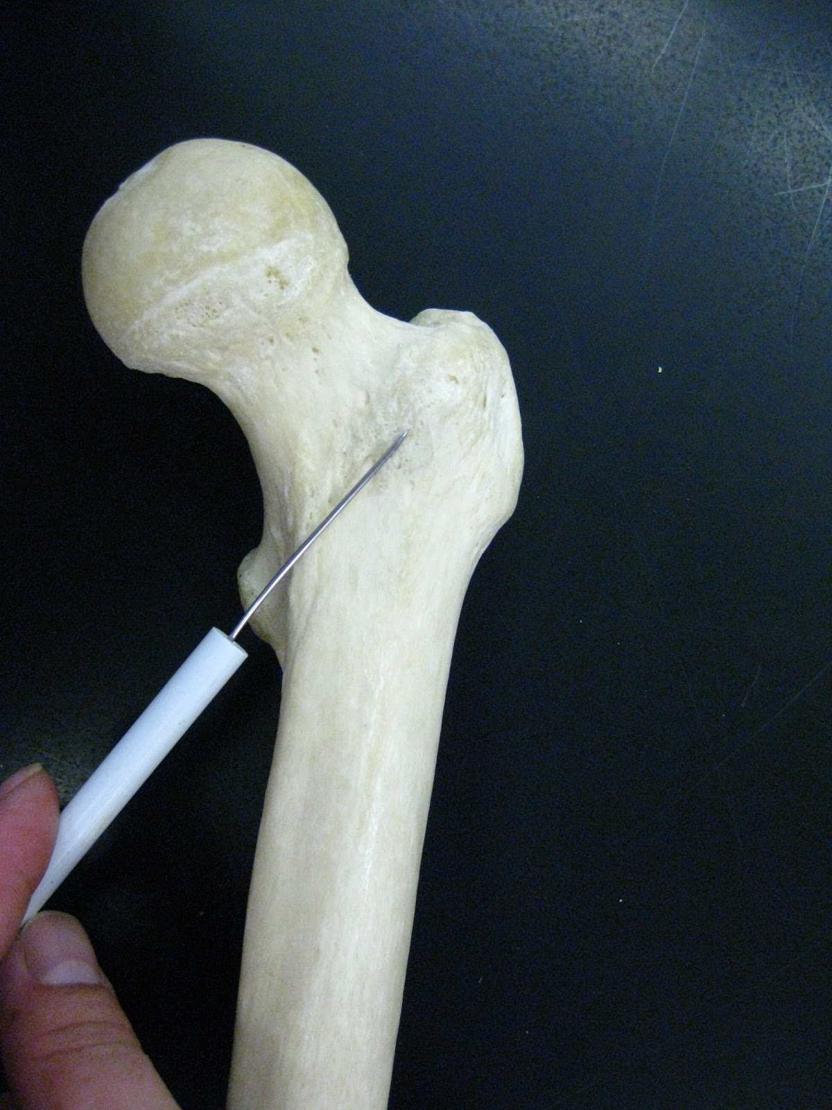 Boned: Human Skeleton - femur