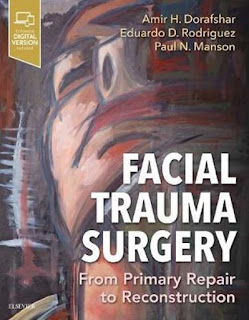Facial Trauma Surgery