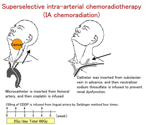 Department of OtolaryngologyHead and Neck Surgery, Hokuto