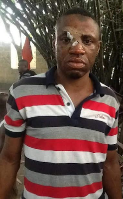 7 Photos: Scores injured as Hausa scrap dealers allegedly attack residents of Itiam Etoi community, Akwa Ibom