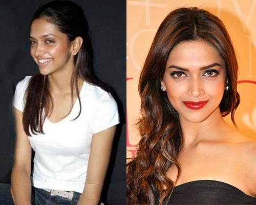 Bollywood Actresses Shocking Photos Before And After Plastic Surgery