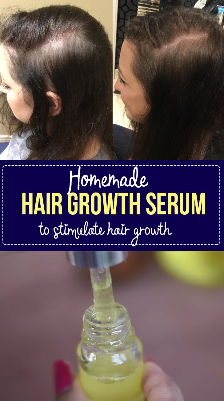 Homemade diy hair growth serum to stimulate hair & stop hair fall ...