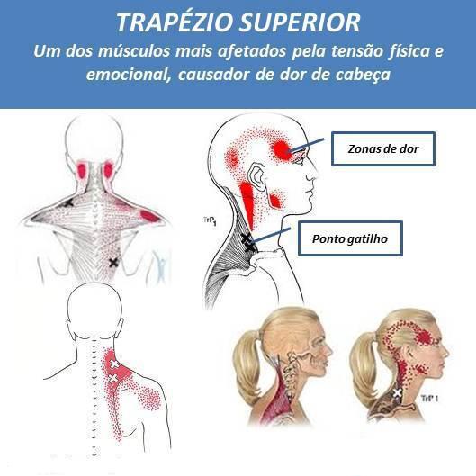 Acupuntura, Saúde e bem estar Jundiaí Dores de cabeça e no pescoço por tensão muscular Acupuntura, Saúde e bem estar Jundiaí Dores de cabeça e no pescoço por tensão muscular