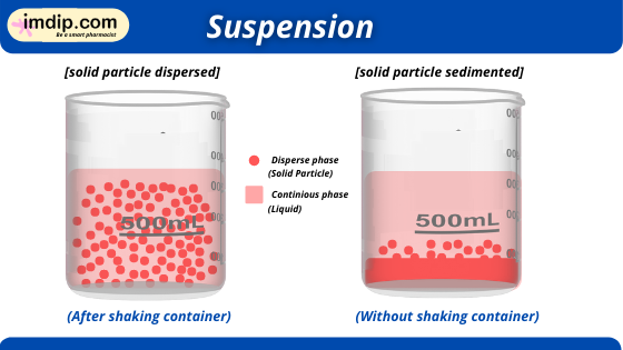 classification of Suspension,