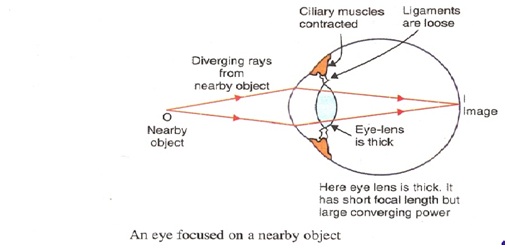 Human Eye defe3 - मानव नेत्र और उसके दोष