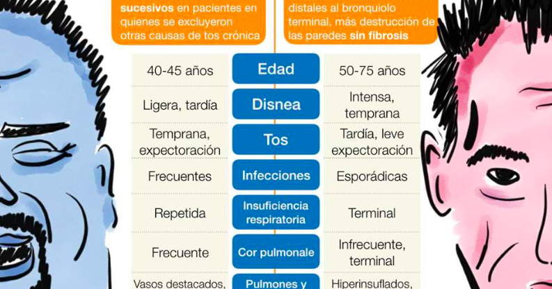 Bronquitis Crónica vs Enfisema Pulmonar; Aprende las diferencias de una