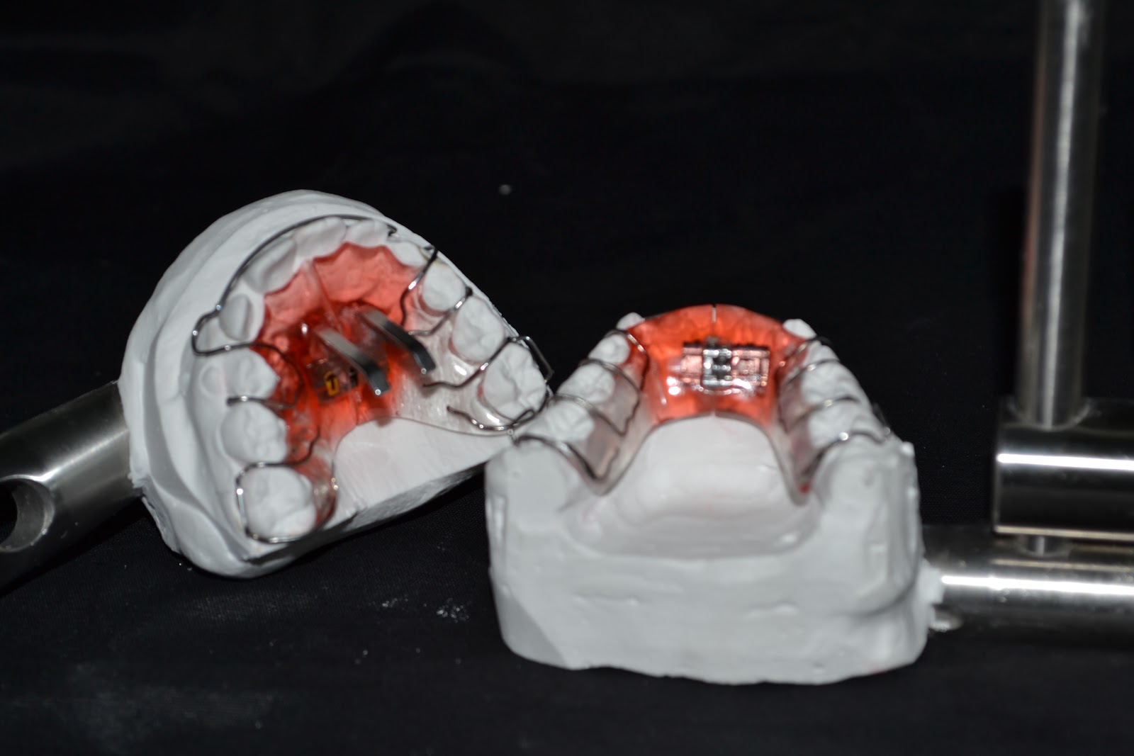 Ortodonzia Fissa · Mobrici-Rastelli - Foto 9