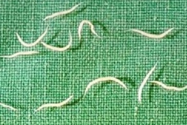 Cara menghilangkan cacing kremi secara alami