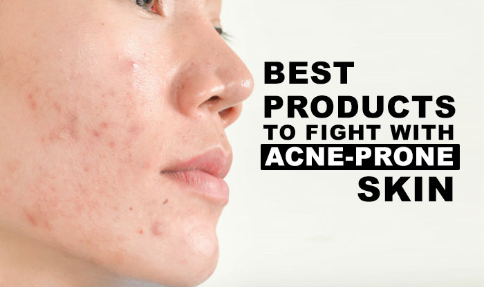 Best Products to deal with Acne-Prone Skin | NeoStopZone