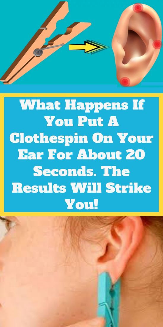 Place a Clothespin on Your Ear For 20 Seconds. The Results Will