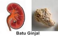 https://4.bp.blogspot.com/-HtePdisAd4E/WaD8WE0CjWI/AAAAAAAAAMY/kuAZmdU6JtAIIk_Kn_7GQmpYNTr7E0jowCLcBGAs/s1600/batu%2Bginjal%2Bampuh.jpg