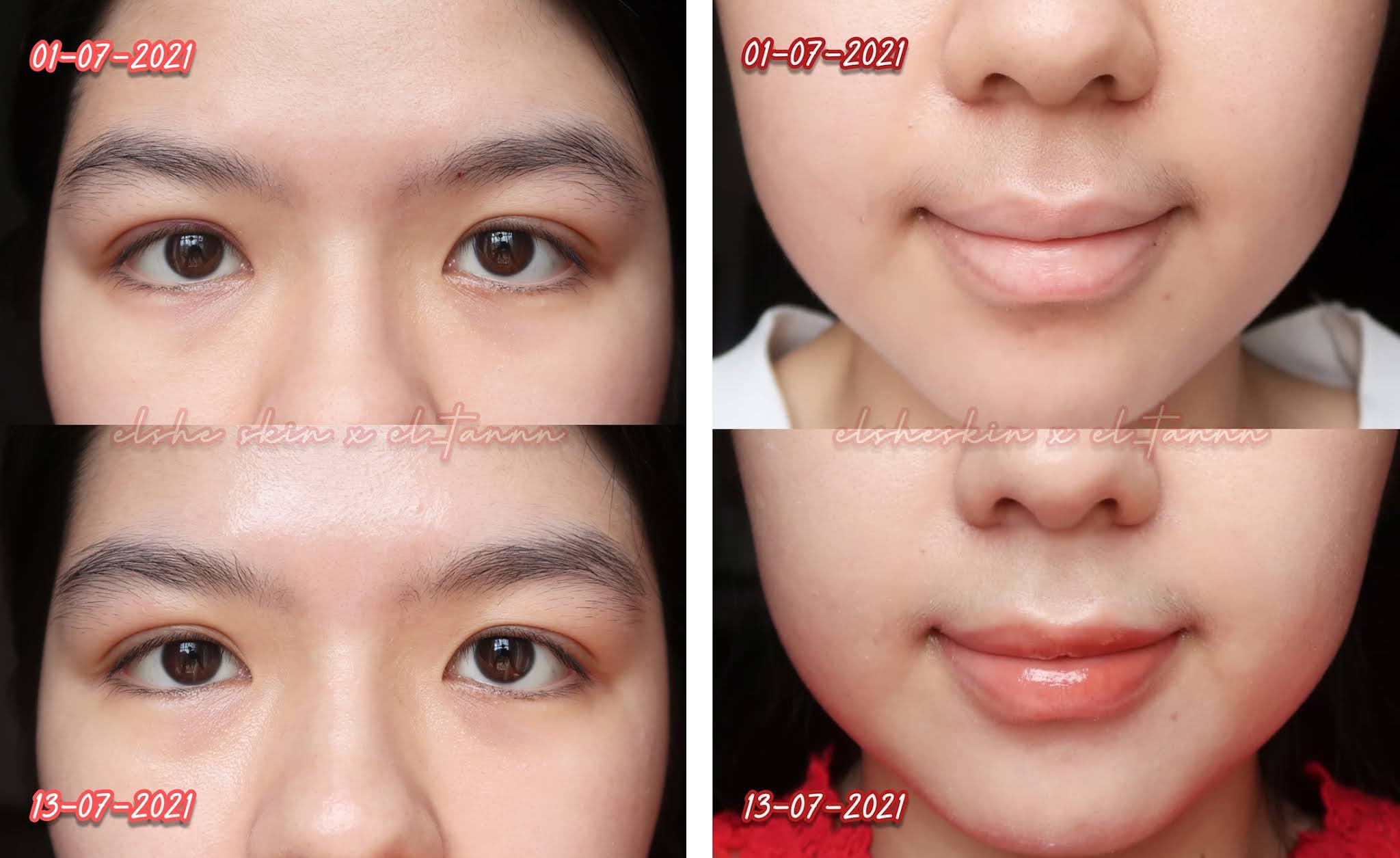 Elsheskin 5 in 1 Eyessential Night Serum Review Eye Serum yang Punya