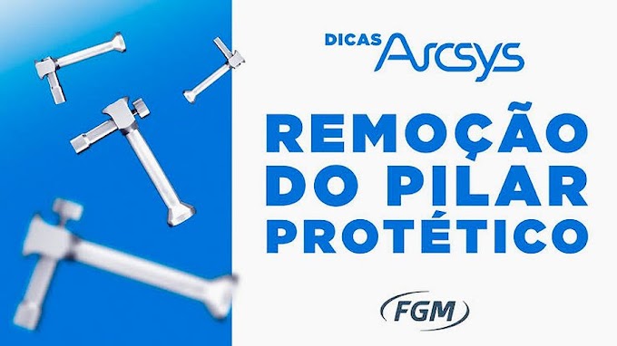 IMPLANTODONTIA: Remoção de pilar protético - Dr. Renato Savi