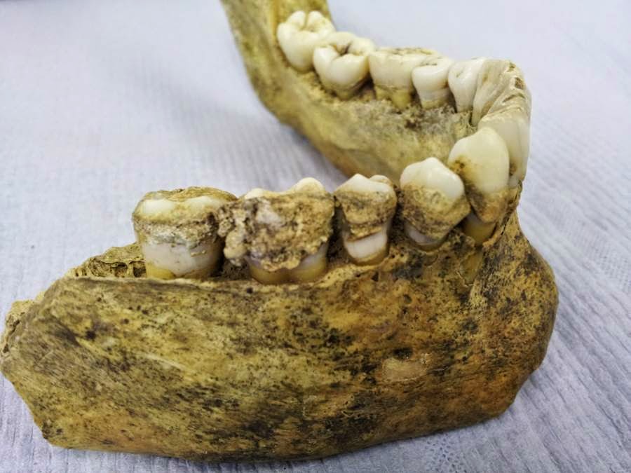 First evidence of milk consumption discovered in ancient dental plaque