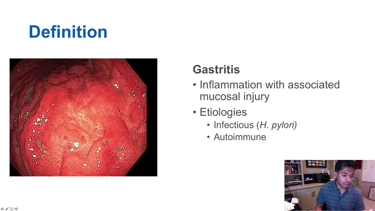 Cuánto tiempo dura una gastritis