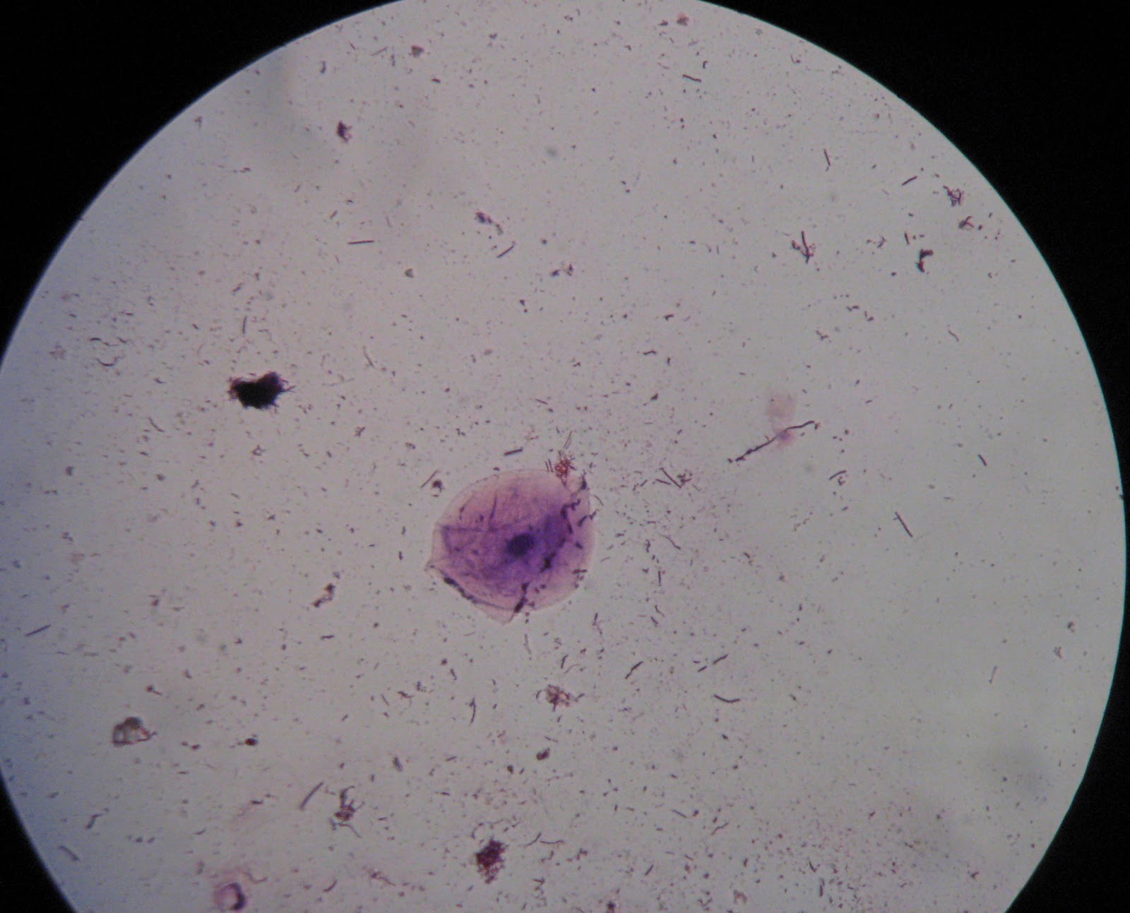 Dental Plaque Sample Under Microscope Unixpaint