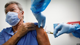    Dokter di AS Sebut Rambut Rontok Merupakan Efek Samping Virus Corona