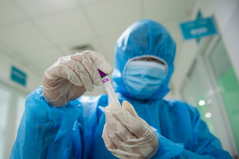 Nhiều bệnh nhân Covid-19 tiên lượng nặng