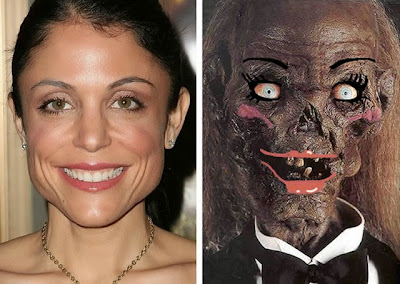 funny Bethenny Frankel before and after cosmetic surgery