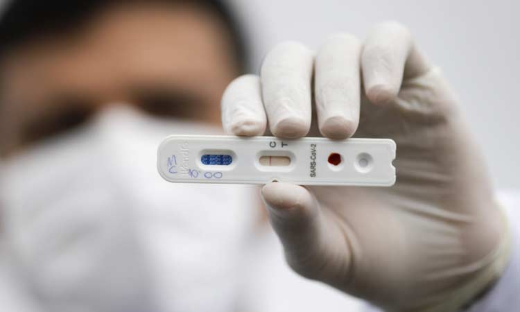 Bahia registra 4.620 casos e 90 óbitos pela Covid-19