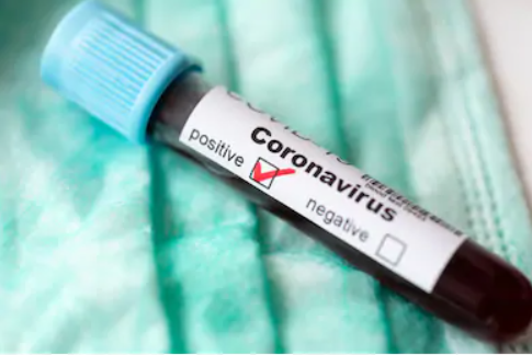المهدية : تسجيل 29 إصابة جديدة بفيروس كورونا