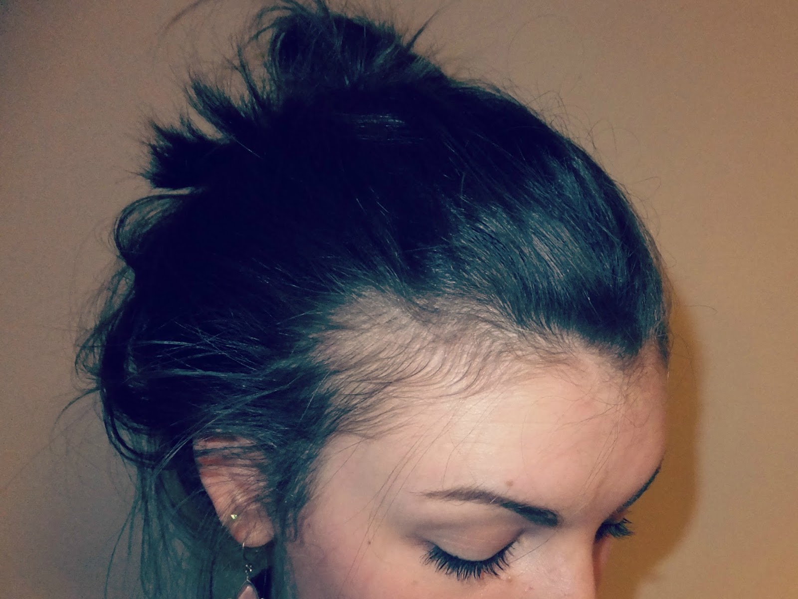 Fern Blush Postpartum Hair Loss What To Expect fern-blush-postpartum-hair-loss-what-to-expect