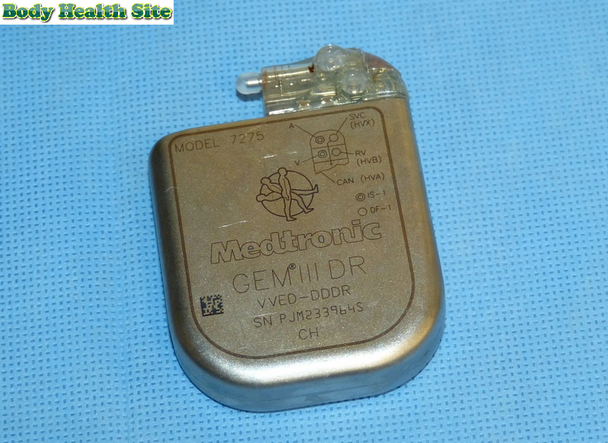 Do all pacemakers have defibrillators Body Health Site