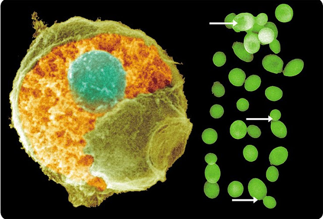 Слева: дрожжевая клетка с удаленным фрагментом клеточной оболочки. Видно округлое ядрои цитоплазматические структуры. Справа: дрожжевые клетки под световым микроскопом. Стрелками показаны почкующиеся дрожжи.