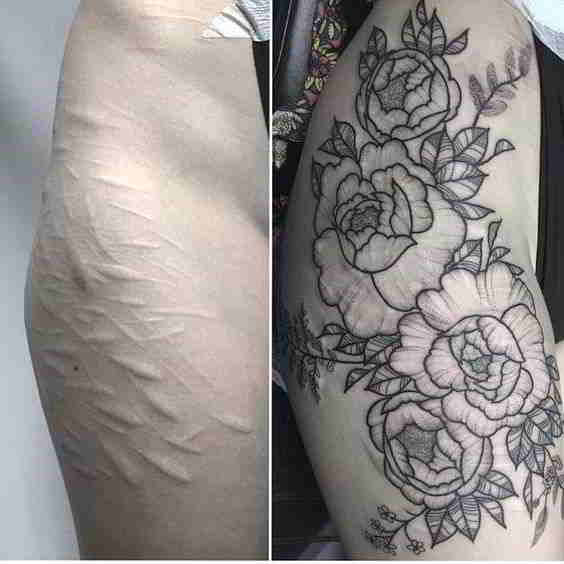 tatuajes para tapar estrias y varices