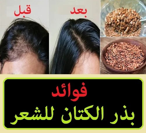 فوائد بذر الكتان للشعر حسب ما اعلنته مراكز الابحاث العالمية