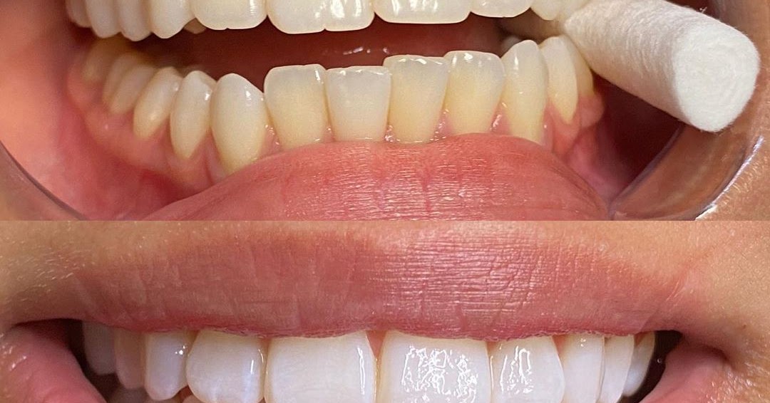 Comment préparer un dentifrice avec des ingrédients naturels pour