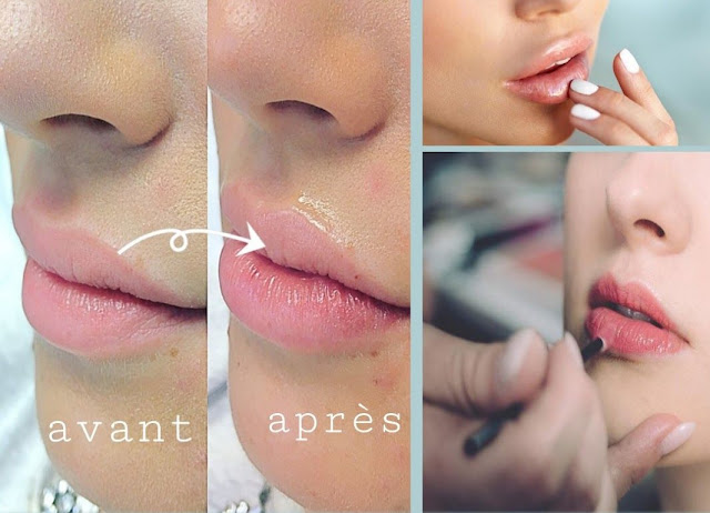 Astuces pour avoir des lèvres douces et volumineuses