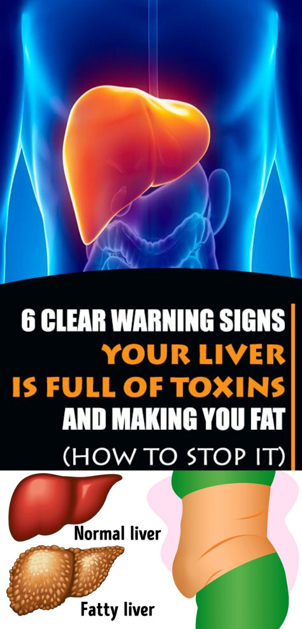 6 Clear Warning Signs Your Liver Is Full of Toxins and Making You Fat