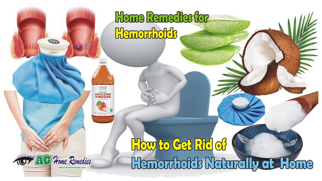 Home Remedies for Hemorrhoids How to Get Rid of Hemorrhoids Naturally at Home Natural Cure Way
