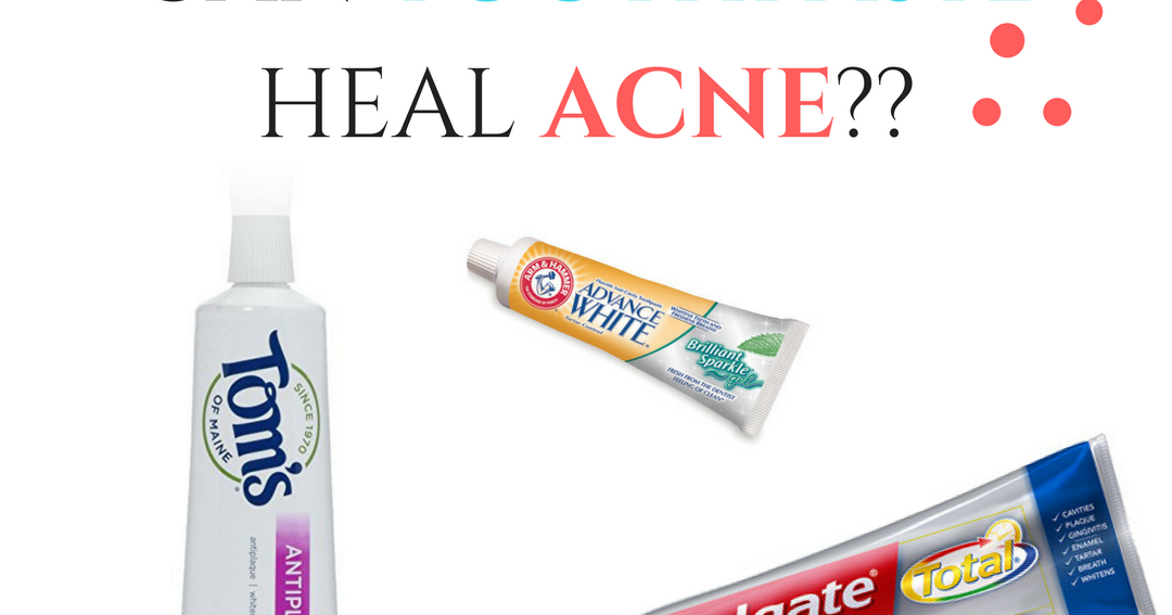 Can Toothpaste Heal Acne?????? Aleithia Wilbert