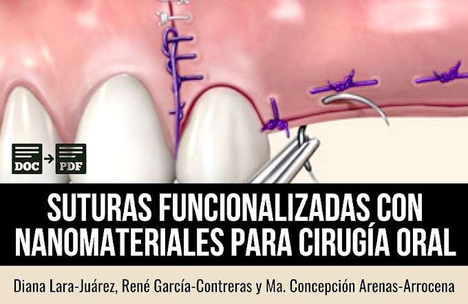 PDF: Suturas funcionalizadas con nanomateriales para cirugía oral: revisión sistemática